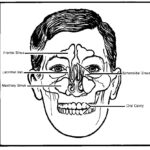 Anatomy of the skull