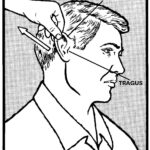 Demonstration of Movement of the auricle.