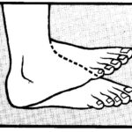 drawing showing Dorsiflection of the foot