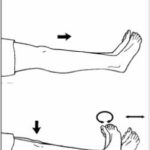 Leg exercises to prevent blood stasis.