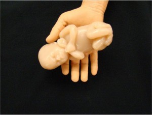22 Week Fetus Model