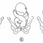 Figure 10-4. Breech positions.