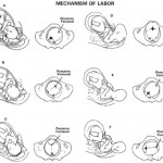 Figure 10-6. The mechanism of labor in the left occiput anterior (LOA) presentation.