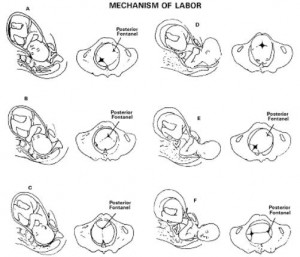 Figure 10-6. The mechanism of labor in the left occiput anterior (LOA) presentation. 