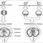 Figure 2-11. Development of twin fetuses.