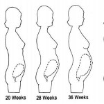 Figure 5-3. Postural changes during pregnancy.