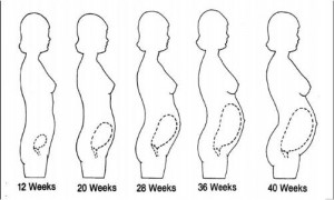 Figure 5-3. Postural changes during pregnancy.