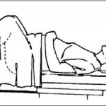 Figure 6-3. Patient in the lithotomy position, draped for pelvic exam.