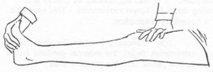 Figure 8-1. Relief of muscle cramp.