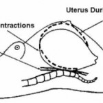 Figure 2-3. Uterus between and during contractions.