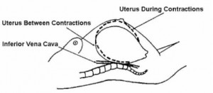 Figure 2-3. Uterus between and during contractions.