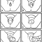 Figure 2-8. Birthing process.