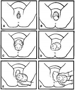Figure 2-8. Birthing process.
