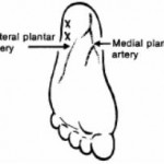 Figure 8-11. Puncture site (X) on sole of infant's foot for heelstick sample.