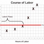Latent Phase of Labor