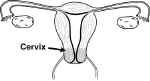 Cervix_small.jpg (2497 bytes)