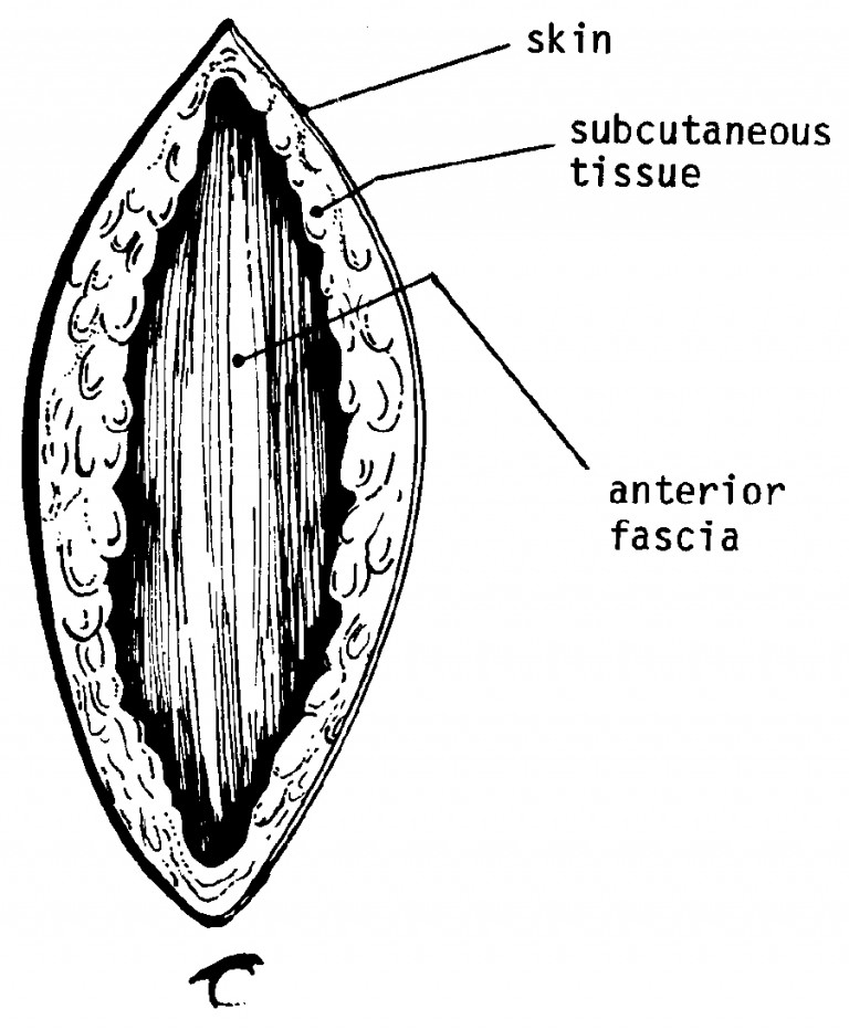 Anterior Fascia 