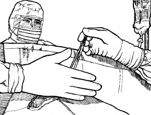 Figure 4-3. Scrub handing tonsil hemostat to surgeon.