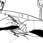 Figure 4-4. Scrub handing tissue forceps to surgeon