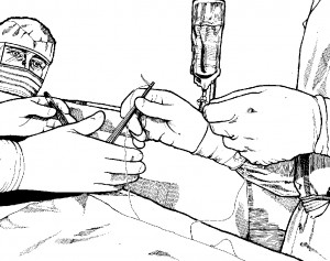 Figure 4-5. Scrub passing a threaded suture in a needle holder.