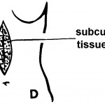 Subcutaneous Tissue