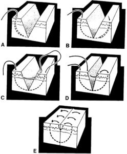 Figure 2-11. The vertical mattress suture