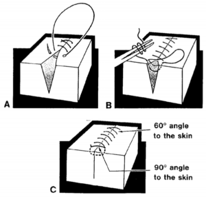 Figure 2-9. The running suture.