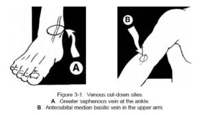 Figure 3-1. Venous cut-down sites.