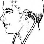 Figure 5-4. Earpiece of stethoscope in place for use.