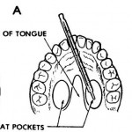 Figure 2-9. Positioning an oral thermometer.