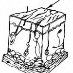 Figure 1-1. Abrasion.