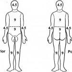 Figure 3-4. Rule of nines for adult body surface burns