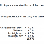 Figure 3-6. Calculating percentage of burn, example 1.
